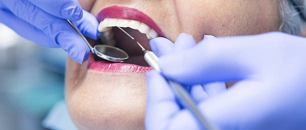 Emergency Dental Filling Replacement in NE
